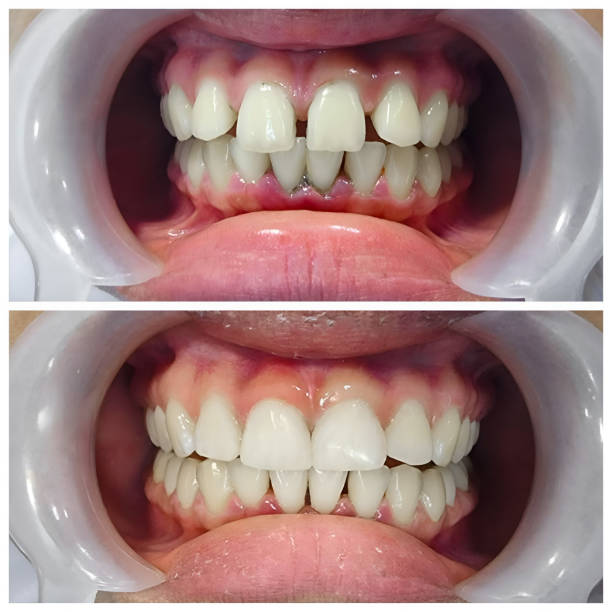 Best Full Mouth Reconstruction  in Conshohocken, PA